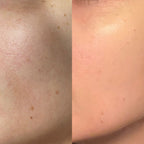 Routine Pelle Normale