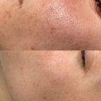 Routine Pelle Grassa