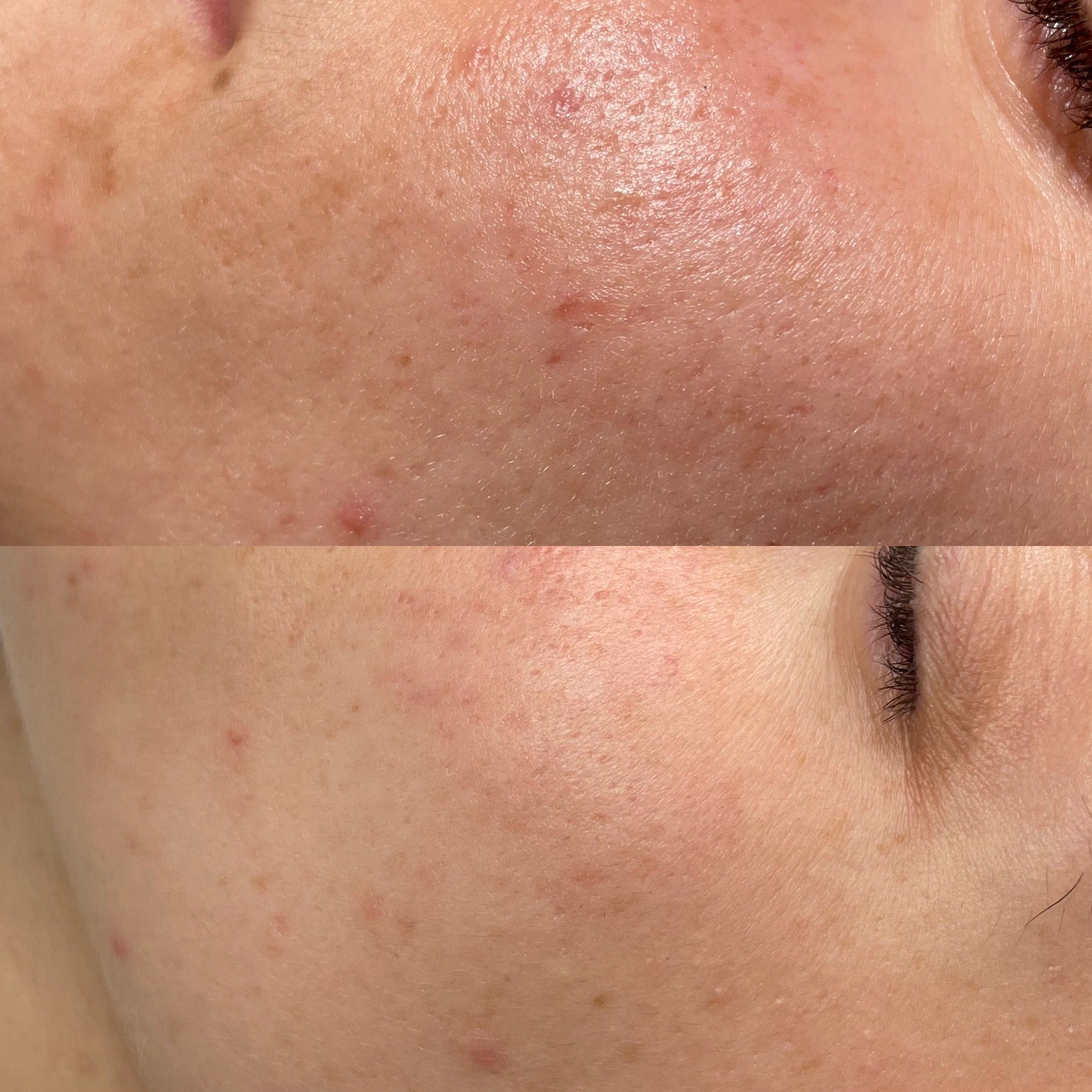 Routine Pelle Grassa