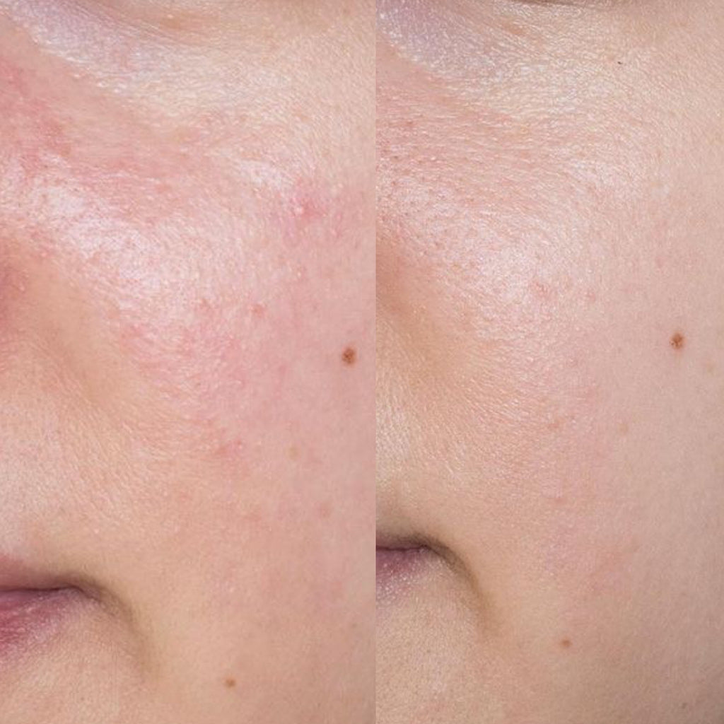 Routine Pelle Secca/Sensibile