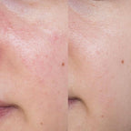 Routine Pelle Secca/Sensibile